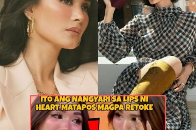 MATAPOS MAGPARETOKE, LIPS NI HEART EVANGELISTA ITO ANG SINAPIT! ANG KONTROBERSYAL NA PAGBABAGO NA NAGPAHINA SA KALIDAD NG KANYANG KARAMDAMAN!