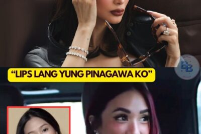 Heart Evangelista Admits to Lip Enhancement, But Netizens Claim She’s Had More Work Done – What’s the Truth?