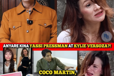 Coco Martin forgives Katherine Luna, offers to have her eyes, teeth fixed