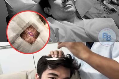 GULAT NA GULAT ANG BUONG PILIPINAS! Bukol ni Luis Manzano, Akala’y Simpleng Sakit—Pero ANG NATUKLASAN NG MGA DOKTOR ay MAS MALALA PA sa INAAKALA! May LIHIM NA ITINATAGO? 😱