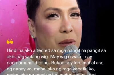 Vice Ganda Removes Wig on Live TV — Karylle Posts Touching Message That Leaves Fans Emotional
