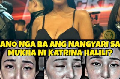 OMG! Diyos Ko Po! Katrina Halili, Hindi Makikilala Matapos ang Nangyari sa Mukha Niya — Ano ang Totoong Dahilan?!