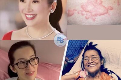 Autoimmune Illnesses: Why More Celebrities Are Speaking Up ?