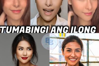 “Sanya Lopez, BINAHAN ng BATIKOS matapos ang Di-umano’y Nose Job! Netizens NAGULAT sa ANYO — ‘Mukha na raw BRUHA sa HABA ng ILONG!’”