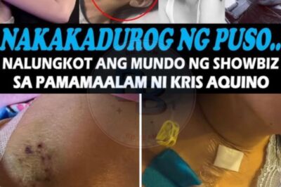 Kris Aquino’s heartbreaking health battle has left the nation in shock and disbelief. The thought that Bimby may not be able to see his mother during this crucial time has added an emotional layer to an already devastating situation. With her strength and determination, Kris continues to inspire, and the public stands by her side, offering love and prayers as she fights this battle.