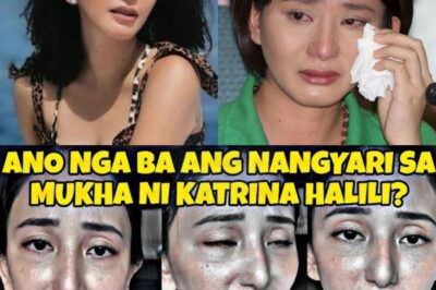 OMG! Ano’ng Nangyari sa Mukha ni Katrina Halili? Mga Fans, Nagulat nang Mag-viral ang Shocking na Larawan — ‘Hindi Ito ang Katrina na Kilala Namin!’ Netizens, Nagsalita sa Pagka-disbelief at Pag-aalala!
