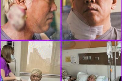 MULA SA TAPING HANGGANG SA HOSPITAL: si ate gay na inaakala lang na ‘parang beke lang’ ang problema, nauwi sa malaking bukol, paulit-ulit na pagdurugo, doktor: walang lunas, pangamba at luha araw-araw — isang nakakaawang kwento ng bituin na nawalan ng pag-asa at humihiling ng dasal at suporta.
