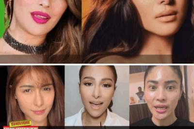 She Only Wanted a Perfect Nose, But Ended Up With Public Humiliation: The Painful Truth Behind Sanya Lopez’s Botched Surgery and the Explosive Reaction of RR Enriquez That Shocked Showbiz