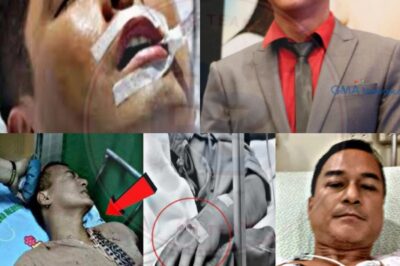 GARDO VERSOZA NAAKSIDENTE HABANG NASA TAPING,AGAW BUH4Y!KALUNOS-LUNOS ANG SINAPIT