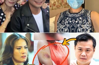 SHOCKWAVE IN SHOWBIZ: Bianca Manalo CL.AI..MS She Was Brutally As.sa..uIted by Senator Win Gatchalian — Shocking Br.ui..ses EXPOSED and Her Cryptic, Heart-Wrenching Post Leaves Netizens in a Frenzy of Speculation!