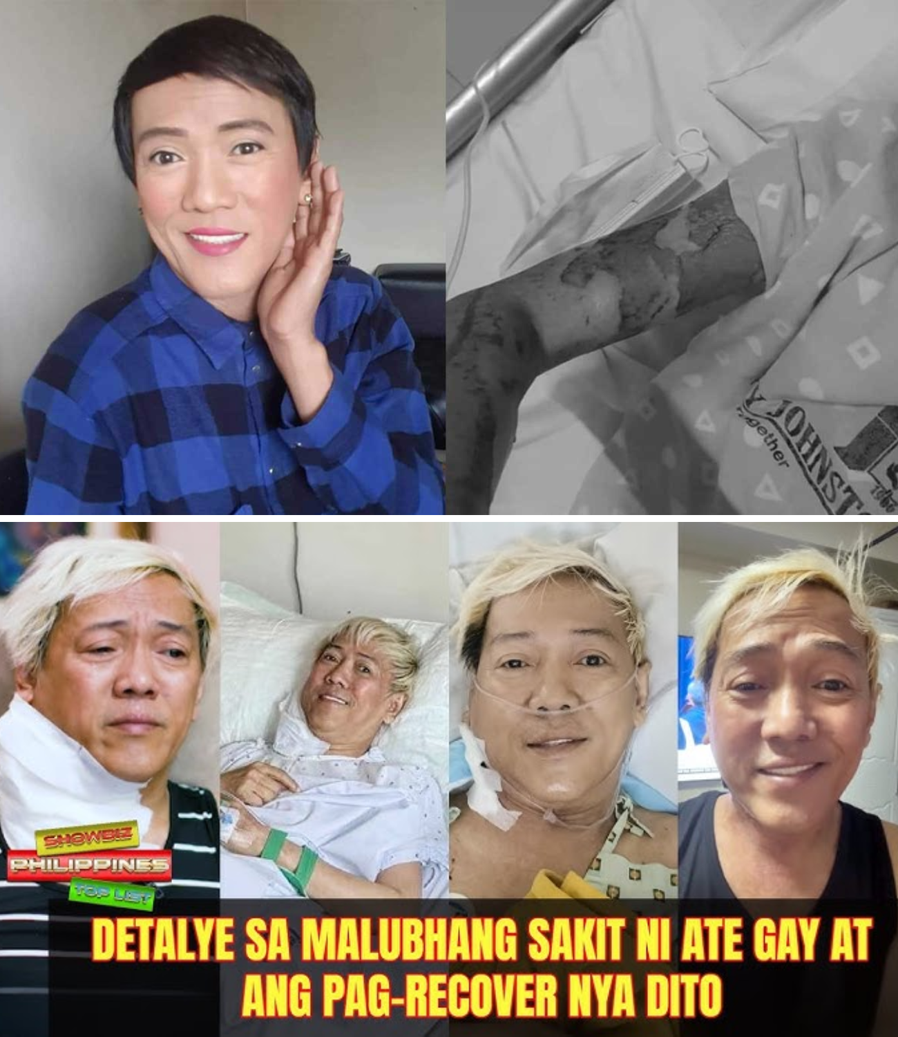 Ate Gay’s Heartbreaking Health Battle Shocking Diagnosis, Tearful